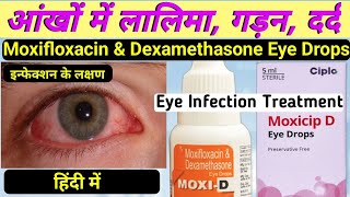 moxi d eye drops hindi  moxifloxacin and dexamethasone eye drops  moxicip eye drops in hindi [upl. by Anyat]