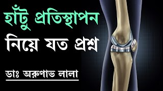 হাঁটু প্রতিস্থাপন  Knee Replacement  in Bengali Interview of Dr Arunava Lala [upl. by Ical17]