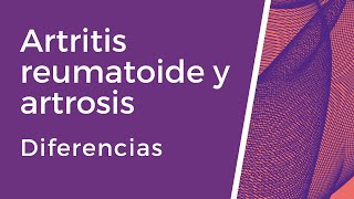 Diferencias entre artrosis y artritis reumatoide Casos prácticos [upl. by Einal78]