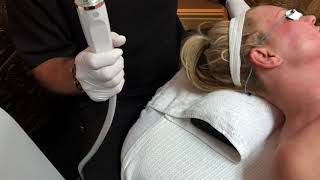 Rick McCoy explains the EndyMed 3Deep RF Microneedling skin tightening treatment at Cascades MedSpa [upl. by Betsy]