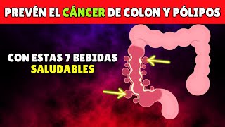 7 Bebidas SALUDABLES Para Prevenir el Cáncer de Intestino y los Pólipos de Colon [upl. by Eerrahs]