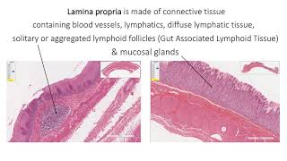 Histology with Chimmalgi General plan of alimentary canal [upl. by Hisbe]