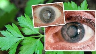 Planta Milagrosa Que Cura 9 Enfermedades De Los Ojos Incluyendo Cataratas [upl. by Iraj]