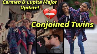 Viral Conjoined Twins Carmen amp Lupita Life Update Fascinating Story [upl. by Refotsirhc873]