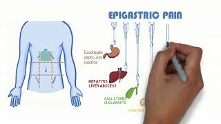 abdominal pain overviewemergency [upl. by Eleda480]