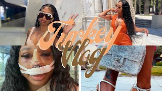 Turkey Vlog  Ethnic Rhinoplasty Journey  Khloe Fifty 50 [upl. by Hamo664]