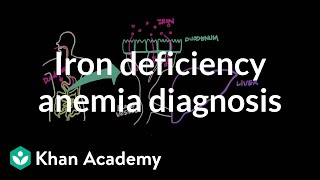 Iron deficency anemia diagnosis  Hematologic System Diseases  NCLEXRN  Khan Academy [upl. by Enomahs590]