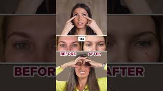 HOW TO REMOVE UNDEREYE BAGS LINK IN BIO [upl. by Ferdinanda178]