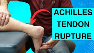 Achilles Tendon Rupture Classic Signs [upl. by Ahgiel351]