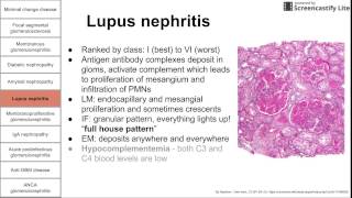 Glomerular diseases [upl. by Johnathan]