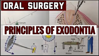 PRINCIPLES OF EXODONTIA II TOOTH EXTRACTION II ORAL SURGERY II imp [upl. by Ebert]