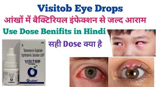 Visitob Eye Drops Use in Hindi आंखों के हर प्रकार की समस्या से तुरन्त आराम eyes drops antibiotic [upl. by Ahseiyt430]