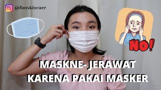 Jerawat karena masker selama COVID19  Maskne tips skincare untuk jerawat [upl. by Fidele376]