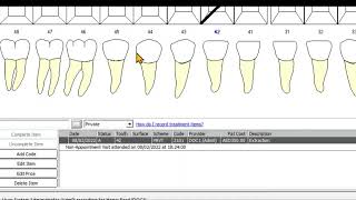 How to add a Treatment plan and more related in R4 [upl. by Nylyak158]