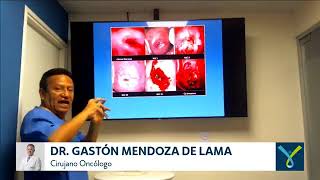 Taller de Video Colposcopia para Obstetras  Con TeleMedicina [upl. by Inotna]