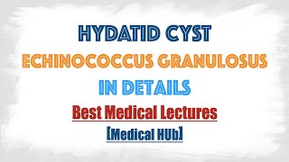 Hydatid cyst of Echinococcus granulosusDog tapeworm  Discussed in details everything you need [upl. by Mariana]