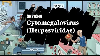 Understanding CytomegalovirusHerpes Virus Family Study Full Lesson Sketchy Medical USMLE Step 1 [upl. by Bartle]