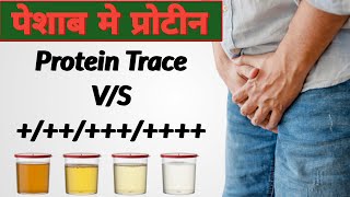 What Is Protein Trace In Urine  Urine Me Protein Trace Kya Hota Hai  Albumin Protein In Urine [upl. by Fricke920]