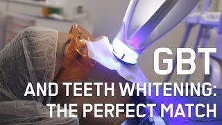 Teeth Bleaching Get Better Results with GBT  Guided Biofilm Therapy [upl. by Gerta57]