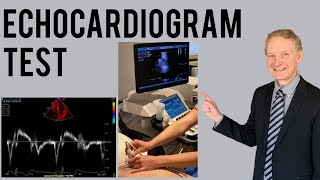 Echocardiogram Procedure  Heart Ultrasound  Everything you need to know [upl. by Merlina]