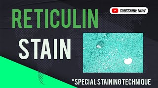 Reticulin Stain  special staining technique [upl. by Ahsikan]