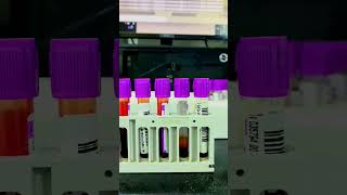 CBC Blood Test Complete Blood Count by Sysmex XN1000™ [upl. by Schilit420]