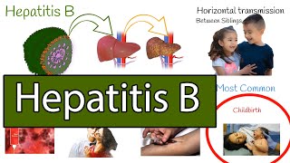 Hepatitis B symptoms treatment and prevention [upl. by Elliot]