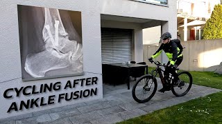 Cycling After Ankle Fusion [upl. by Trocki]