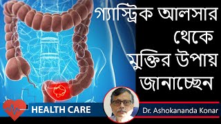 Peptic Ulcer Symptoms  কোন লক্ষণ গুলি হলে বুঝবেন গ্যাস্ট্রিক আলসার হয়েছে  Dr Ashokananda Konar [upl. by Aretak]