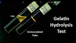 Gelatin Hydrolysis A Biochemical Test for Identification of Gelatinase Enzyme Producing Bacteria [upl. by Lyckman]