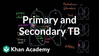 Primary and Secondary TB  Infectious diseases  NCLEXRN  Khan Academy [upl. by Ellison882]