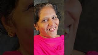 പല്ല് വെറുതെ പറിച്ചുകളയല്ലേ dentalvideos dentalclinic dentalcare dentist thedentalviews [upl. by Maunsell125]