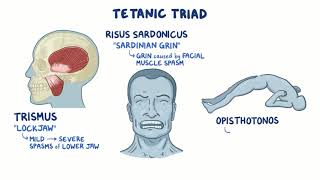 Clostridium tetani tetanus causes symptoms diagnosis treatment pathology [upl. by Rex]