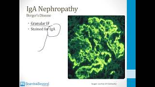 Nephritic syndrome [upl. by Bandur6]