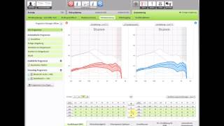 Phonak Rückkopplungsmanager [upl. by Caressa]