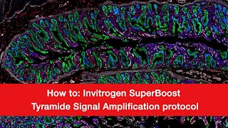 How to Invitrogen SuperBoost Tyramide Signal Amplification Protocol [upl. by Langille]