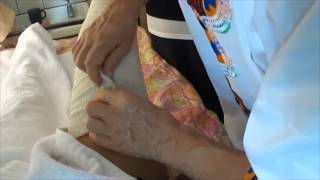 Edema treatment 4 measure and bandage [upl. by Aridaj]