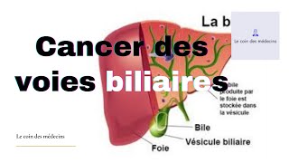 Cancer des voies biliaires [upl. by Adnouqal]