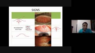 Conjunctival diseases [upl. by Pik]