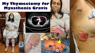 Thymectomy Experience  Myasthenia Gravis [upl. by Brubaker]