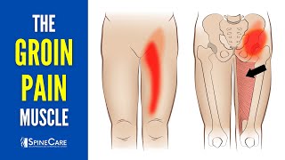 The Groin Pain Muscle How to Release It for INSTANT RELIEF [upl. by Gnivri51]