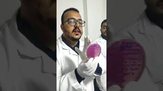 Urine culture case  Ecoli or Klebsiella or Proteus microbiology medicalmicrobiology [upl. by Pedro]