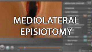 Trailer  Chapter on Episiotomy [upl. by Piero]