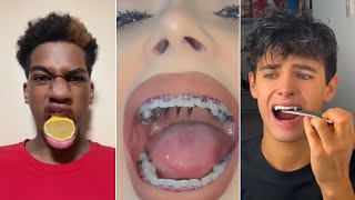 All Your TikTok Dental Pain In One Video [upl. by Fredrick576]