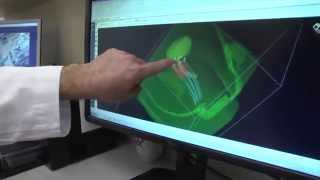 What is radiation therapy and how is it used to treat cancer [upl. by Adrea]