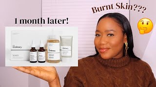 The Ordinary Bright Set Skincare Review [upl. by Reed488]