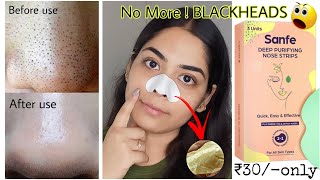 Amazing 😱 Sanfe Deep purifying Nose Strips  How to Apply for best results ❌BLACKHEADSWHITEHEADS [upl. by Hayila]