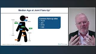 Can YOU Avoid Iatrogenic Harm Understanding and Identifying Fibrodysplasia Ossificans Progressiva [upl. by Nabala]