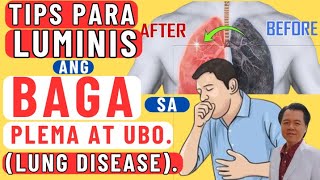 Tips Para Luminis ang Baga sa Plema at Ubo Lung Disease  By Doc Willie Ong [upl. by Orman]