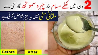 Home Remedies To Get Rid Of Open Pores On Skin  Shrink large pores Naturally At Home [upl. by Gnues]